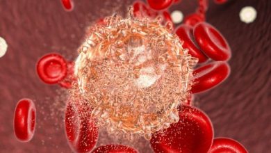 Photo of سرطان الدم قد ينتج عن غياب بعض الميكروبات النافعة