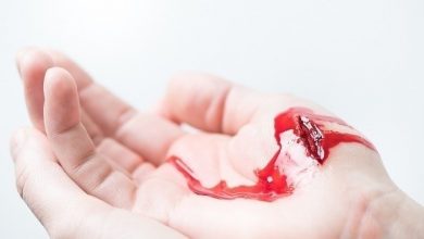 Photo of تسمم الدم يهدد حياتك