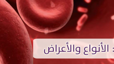Photo of فقر الدم : الأنواع والأعراض