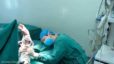 Photo of صورة مؤثرة جدا لطبيب نام في غرفة العمليات