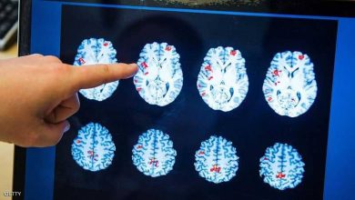 Photo of دماغ الرجل أم المرأة.. دراسة تكشف “الفارق المذهل”