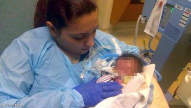 Photo of ولادة نادرة تحير الأطباء في أميركا